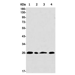 BCL10 rabbit monoclonal antibody