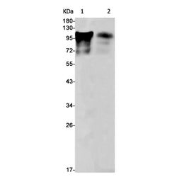 BCL11B rabbit monoclonal antibody