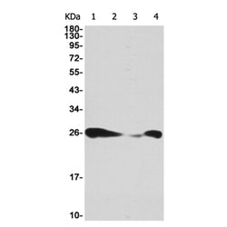 BCL2 rabbit monoclonal antibody