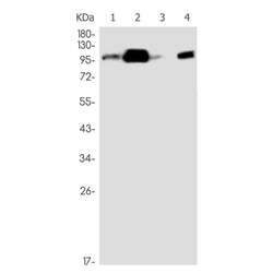 BCR rabbit monoclonal antibody