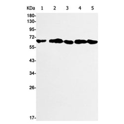 BECN1 rabbit monoclonal antibody