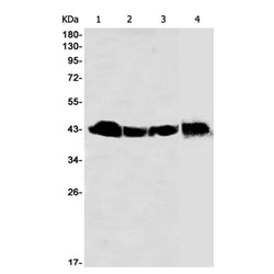 BMI1 rabbit monoclonal antibody