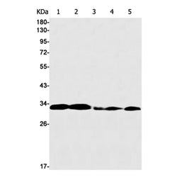 C1QBP rabbit monoclonal antibody