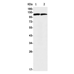 C3 rabbit monoclonal antibody