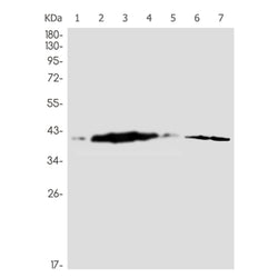 CAB39 rabbit monoclonal antibody