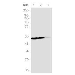 CALR rabbit monoclonal antibody