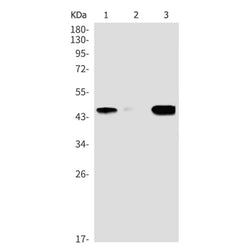 CALU rabbit monoclonal antibody