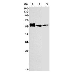 CAMK2A rabbit monoclonal antibody