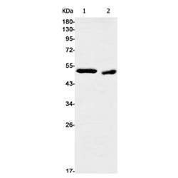 CAP2 rabbit monoclonal antibody