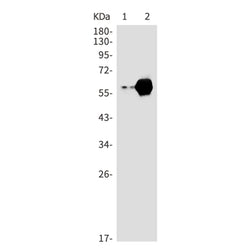 CARD9 rabbit monoclonal antibody