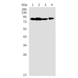 CARS1 rabbit monoclonal antibody