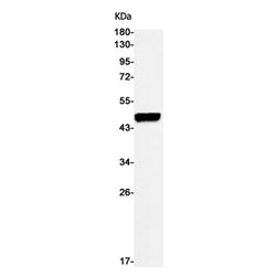 CASP1 rabbit monoclonal antibody
