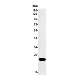 CAV1 rabbit monoclonal antibody