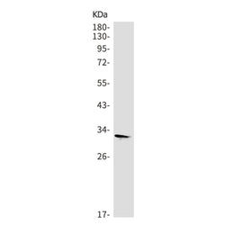 CBR3 rabbit monoclonal antibody