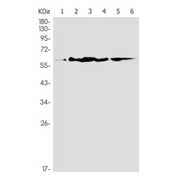 CBX4 rabbit monoclonal antibody