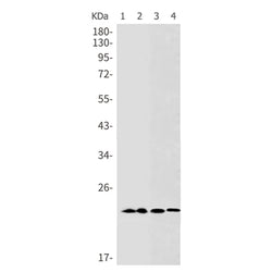 CBX5 rabbit monoclonal antibody