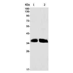 CCN2 rabbit monoclonal antibody