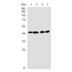 CCNB2 rabbit monoclonal antibody
