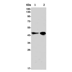 CCNE1 rabbit monoclonal antibody