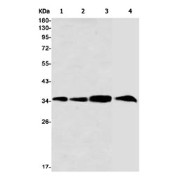 CCNH rabbit monoclonal antibody