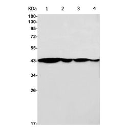 CCR7 rabbit monoclonal antibody