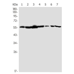 CCT2 rabbit monoclonal antibody