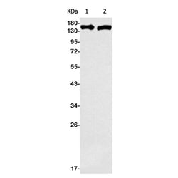 CD22 rabbit monoclonal antibody