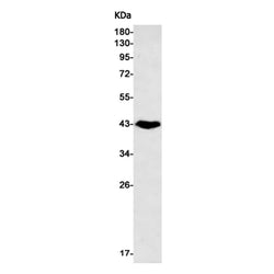 CD79A rabbit monoclonal antibody