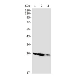 CD81 rabbit monoclonal antibody