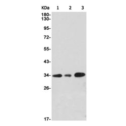 CD8A rabbit monoclonal antibody