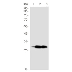 CD99 rabbit monoclonal antibody