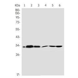 CDC34 rabbit monoclonal antibody