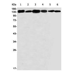 CDH1 (phospho-Ser838/Ser840) rabbit monoclonal antibody