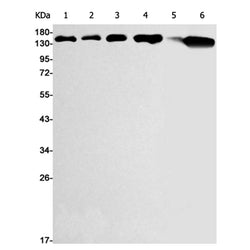 CDH1/CDH2/CDH3 rabbit monoclonal antibody