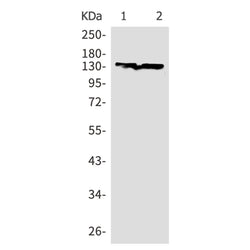 CDH2 rabbit monoclonal antibody