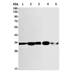 CDK2 (phospho-Tyr15) rabbit monoclonal antibody