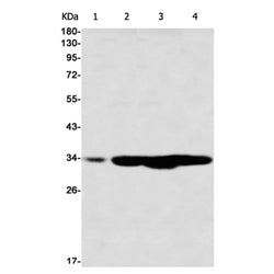 CDK2 (phospho-Thr14) rabbit monoclonal antibody