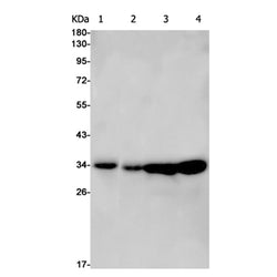 CDK4 rabbit monoclonal antibody