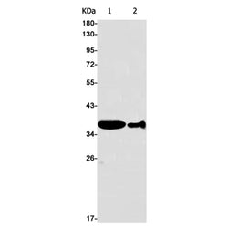 CDK6 rabbit monoclonal antibody