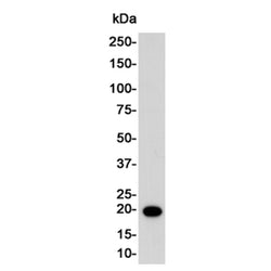 CDKN1A rabbit monoclonal antibody