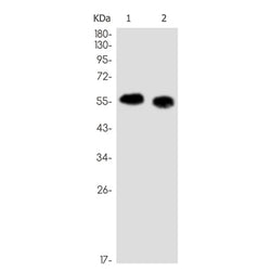 CDKN1C rabbit monoclonal antibody
