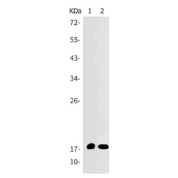 CDKN2C rabbit monoclonal antibody