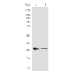 CEBPB rabbit monoclonal antibody