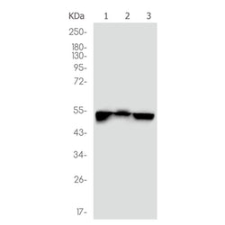 CHEK1 rabbit monoclonal antibody