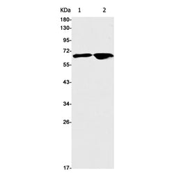 CHEK2 rabbit monoclonal antibody