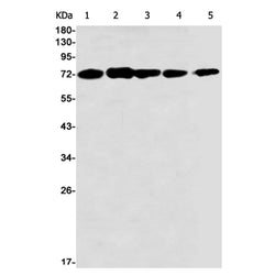 CHRNA4 rabbit monoclonal antibody