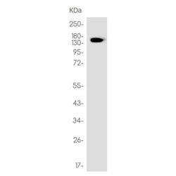 CHUK/IKBKB rabbit monoclonal antibody