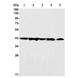 CKB rabbit monoclonal antibody