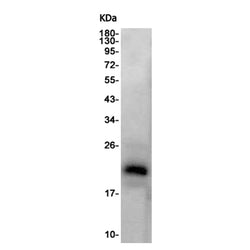 CLDN3 rabbit monoclonal antibody
