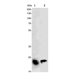 CLEC3B rabbit monoclonal antibody